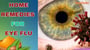 Top Home Remedies For Eye Flu! Symptoms, Causes, and Natural Treatments