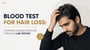 Blood Test for Hair Loss: Common Causes Detected Through Lab Testing!