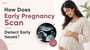 How Does Early Pregnancy Scan Detect Early Issues?