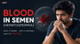 Blood in Semen (Hematospermia): What It Means, Why It Happens, and How It's Treated