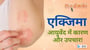 एक्जिमा आयुर्वेद में कारण और उपचार